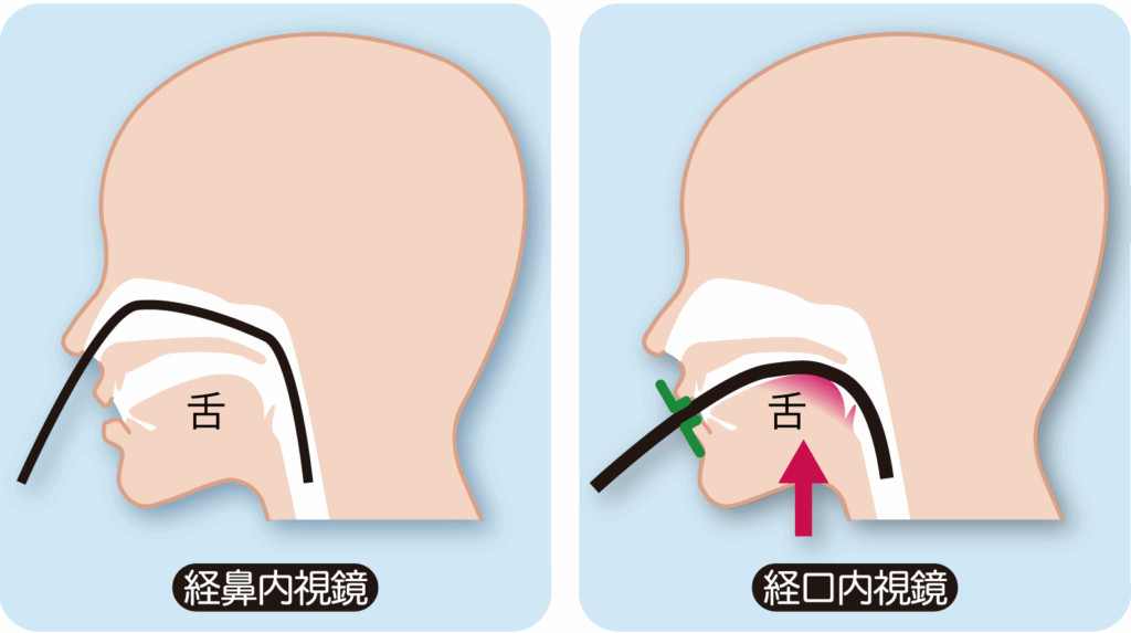 選べる！経鼻・経口内視鏡検査